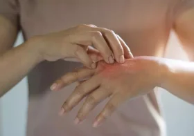 BBC doctor shares update on new eczema treatment approved for NHS